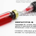 Hepatitis B and liver ultrasound